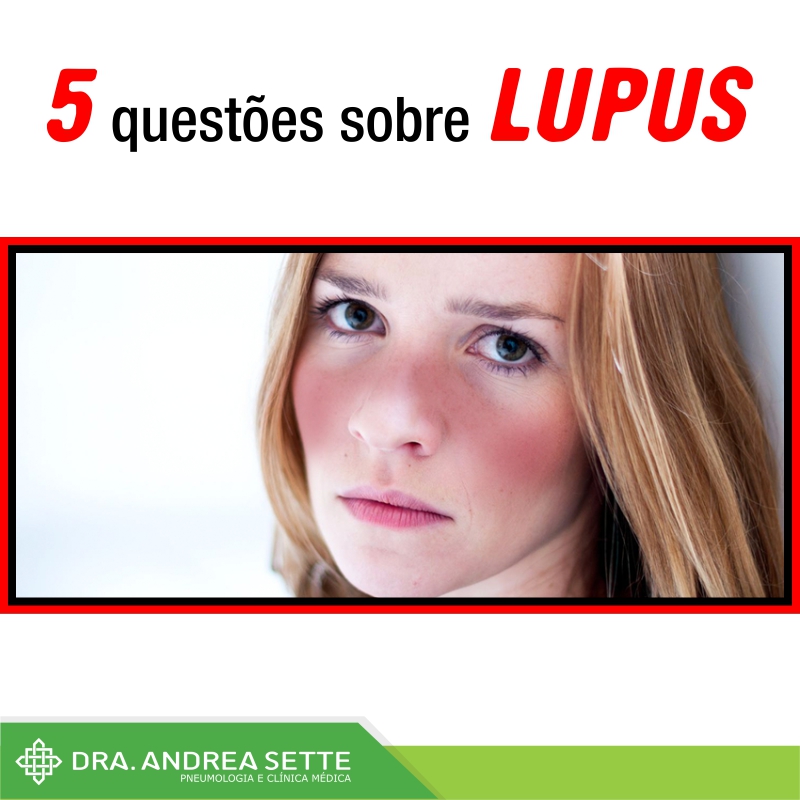 lupus.jpg